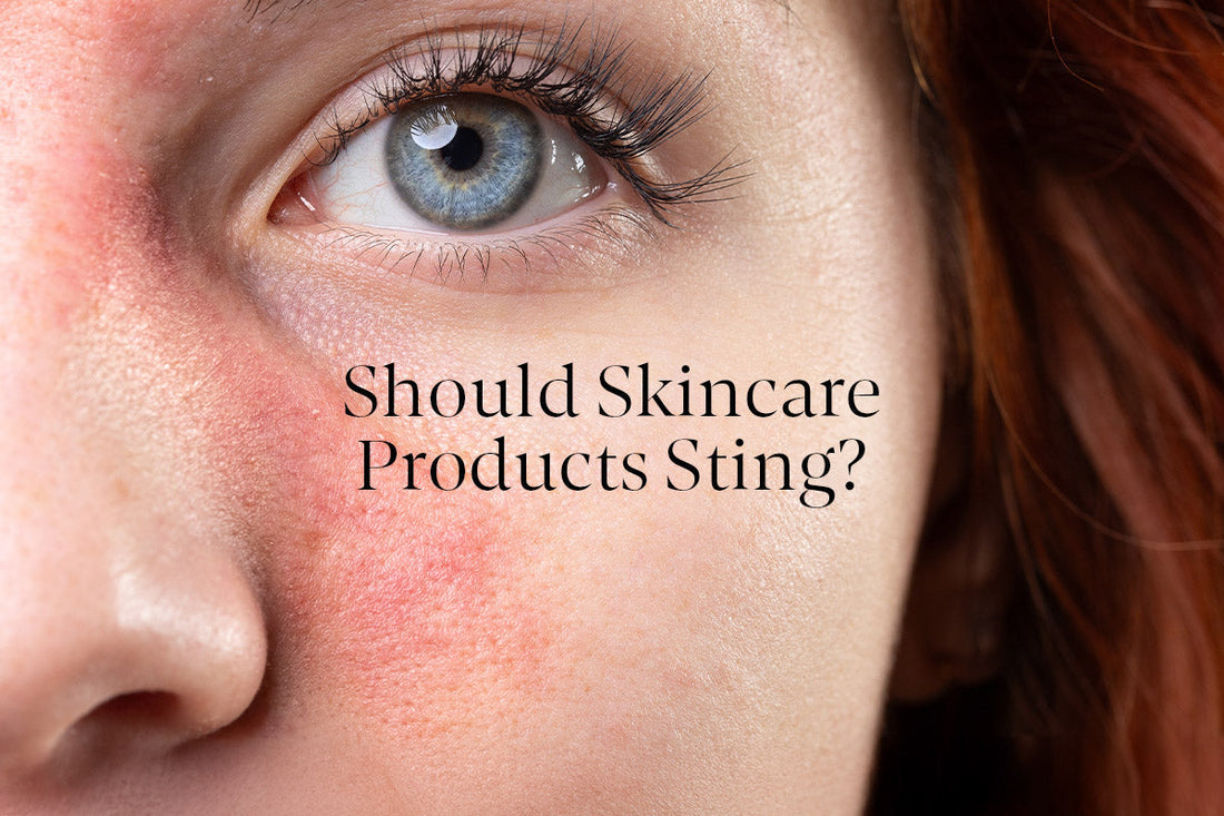 Myth Buster: Should Skincare Products Sting?