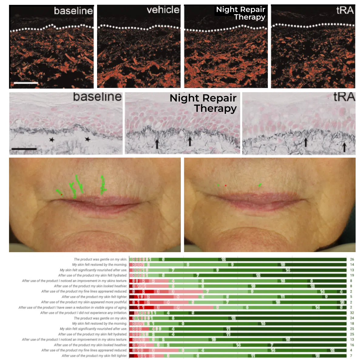 Skin Cell Alignment Cell-to-Surface – The Skin Diary