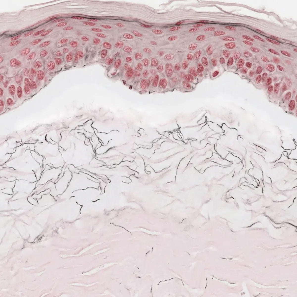Simulation of photoaged wrinkled skin histology using H&E staining, showing degraded collagen structure