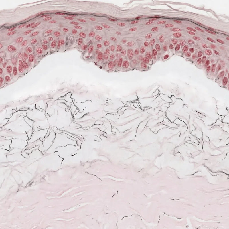 B: Photoaged, Wrinkled Female Facial Skin (H&E)
