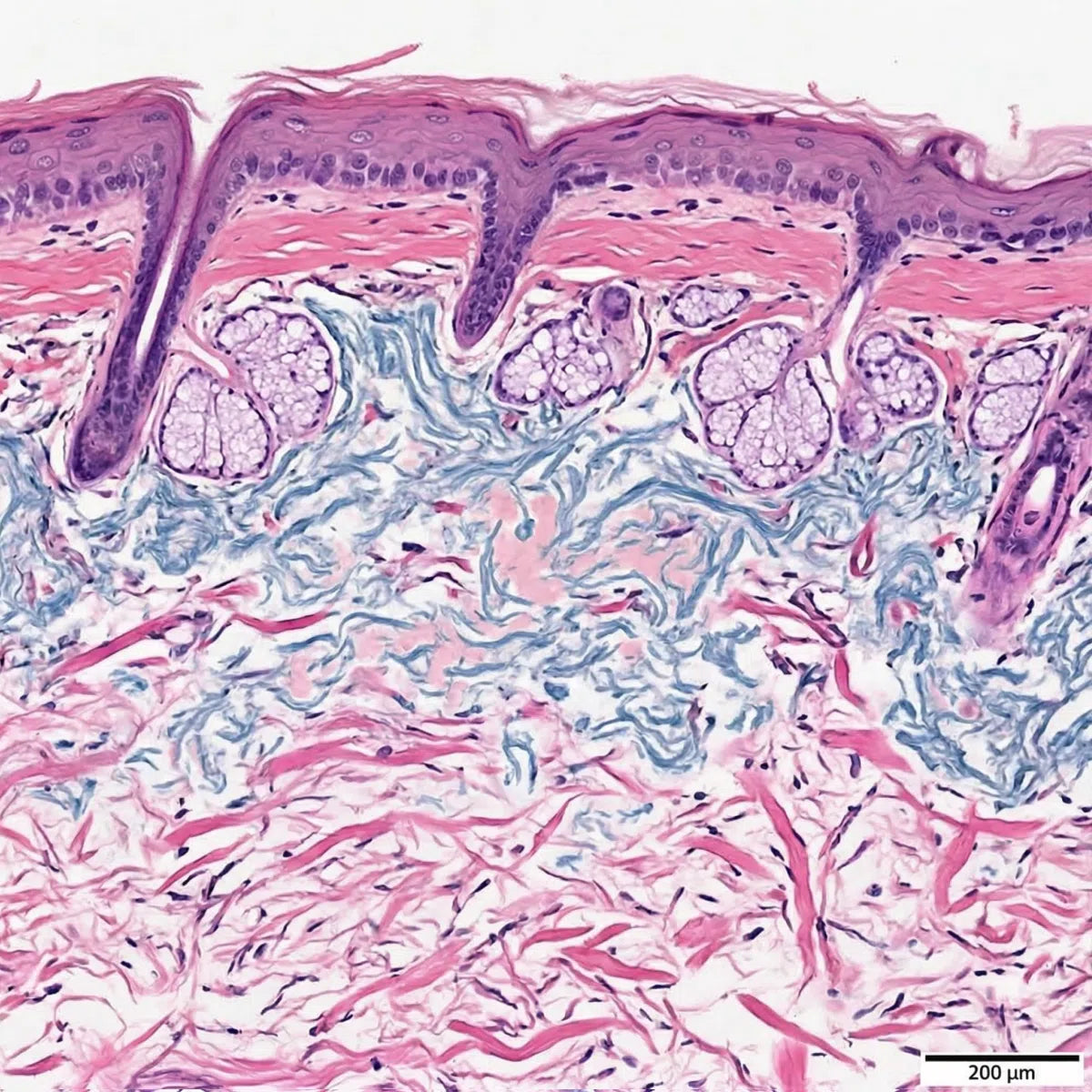 Simulation of photoaged wrinkled skin histology using H&E staining, showing degraded collagen structure