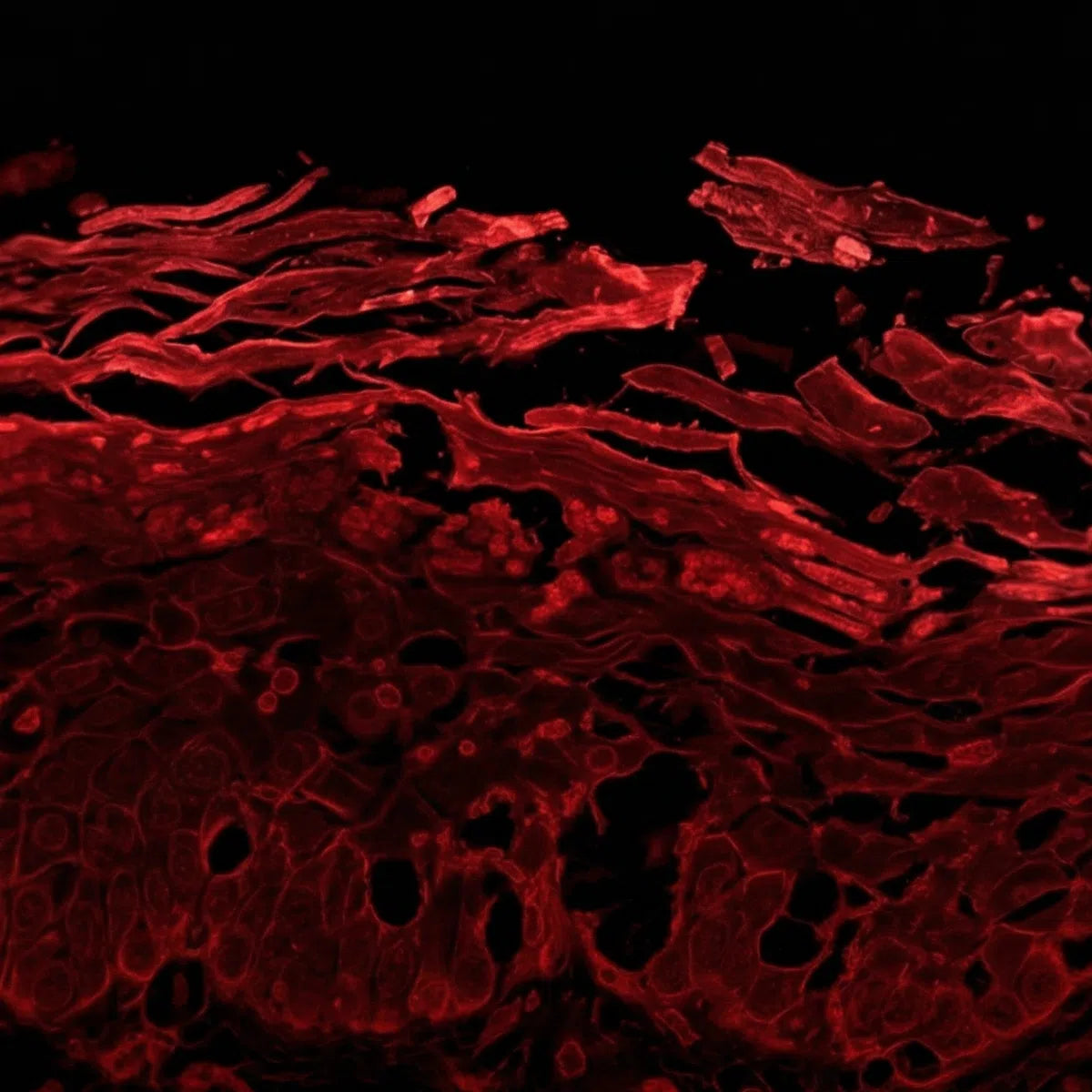 Simulated Oil Red O histology showing dry disorganised flaking old skin, unable to hold moisture and lipids