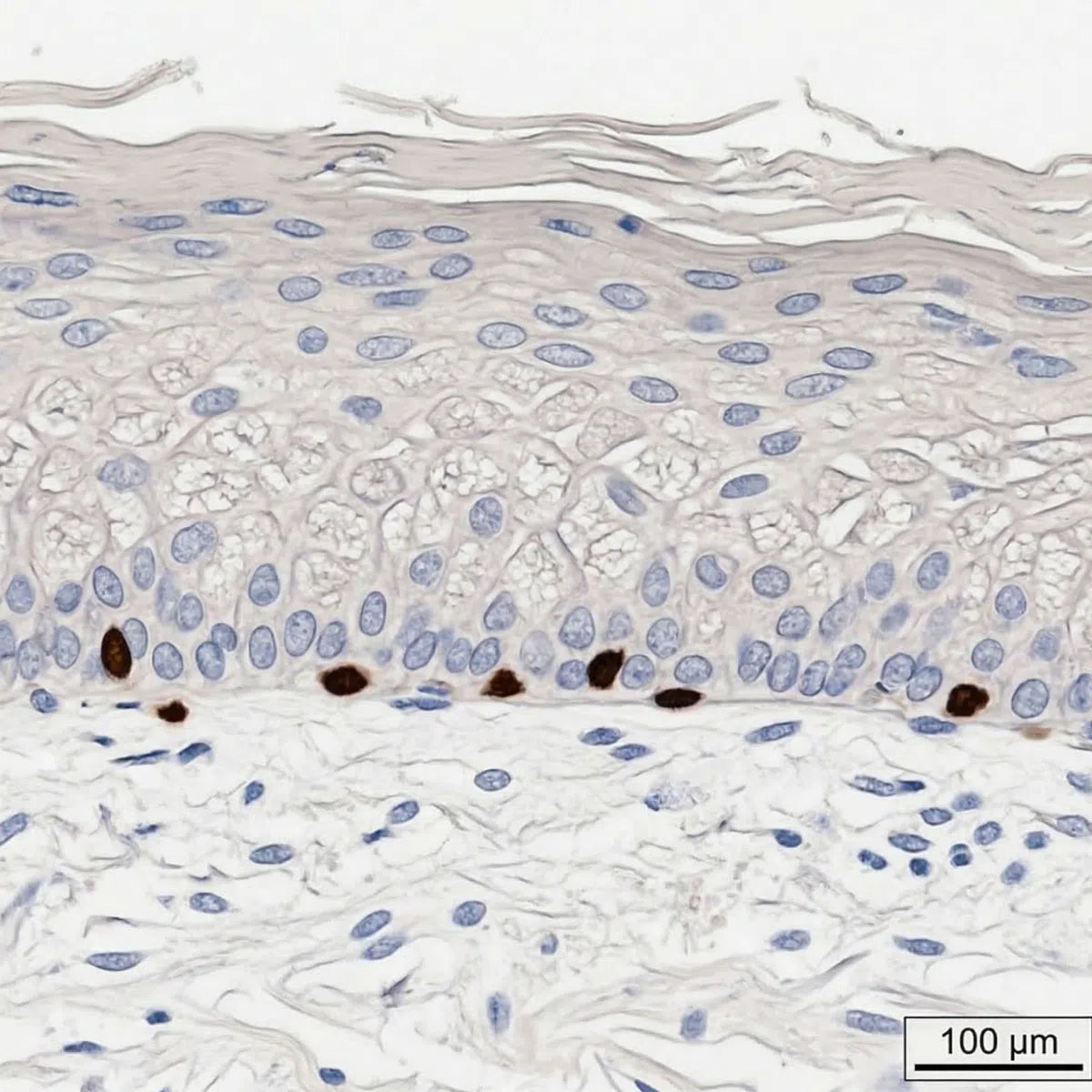Simulation of photoaged wrinkled skin histology using H&E staining, showing degraded collagen structure