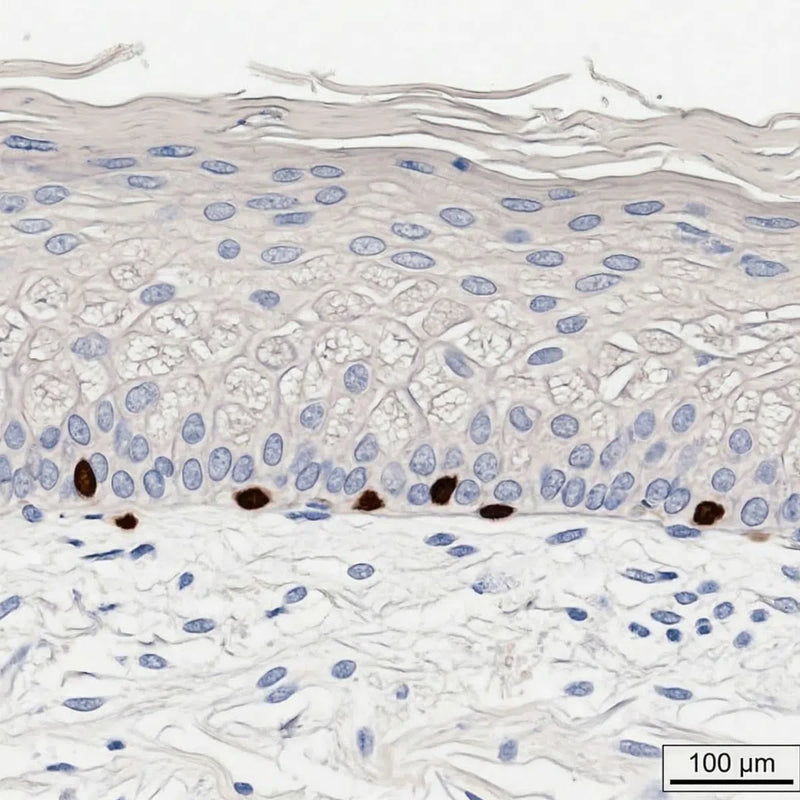 B: Photoaged, Wrinkled Female Facial Skin (H&E)