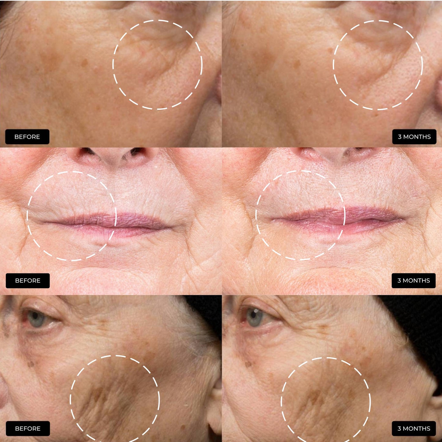 The Ultimate Skin Ageing Duo