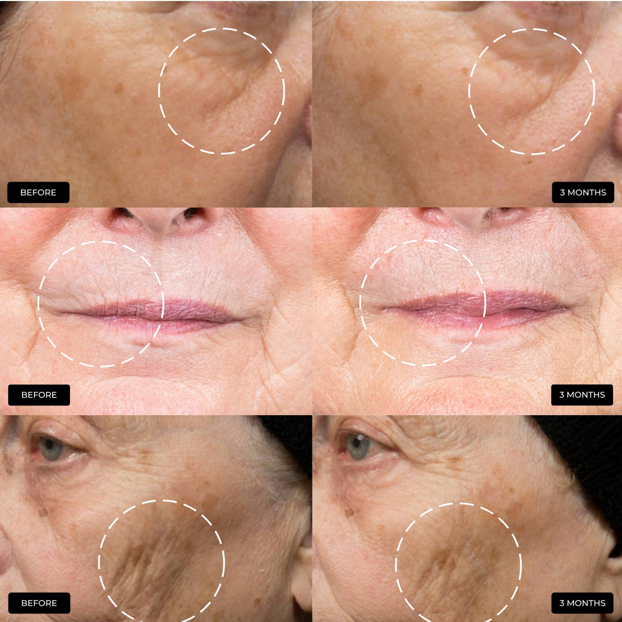 The Ultimate Skin Ageing Duo