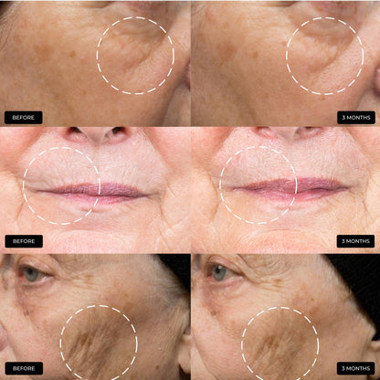 The Ultimate Skin Ageing Duo