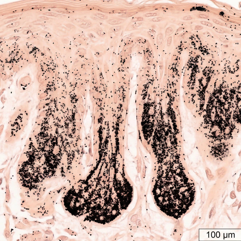 B: Photoaged, Wrinkled Female Facial Skin (H&E)
