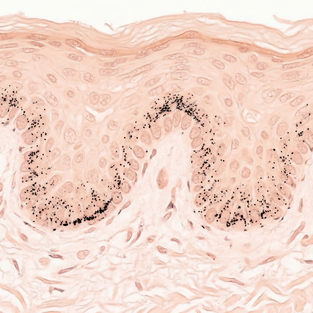 Simulation of even melanin production using Fontana-Masson histology staining