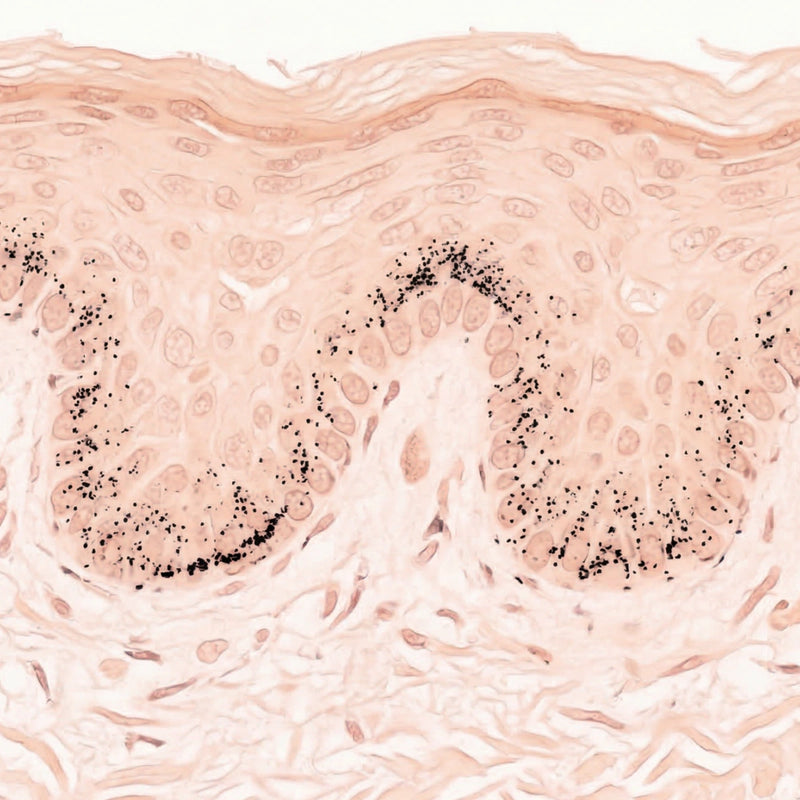 Simulation of even melanin production using Fontana-Masson histology staining