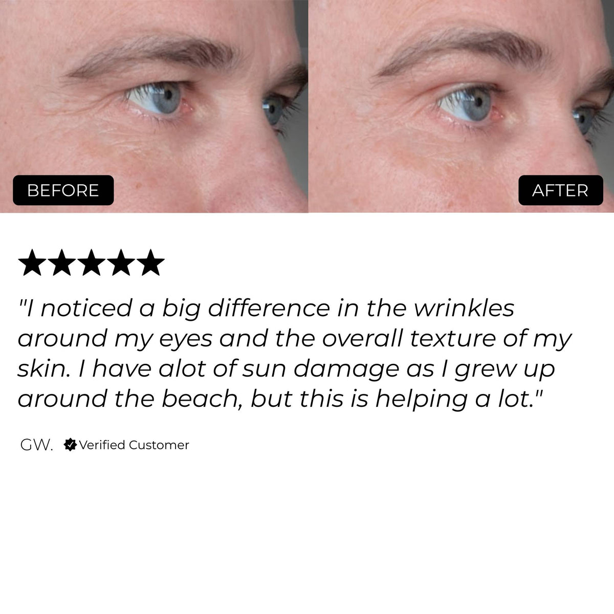 Night Repair Routine Night Repair Therapy | Buy Now – The Skin Diary