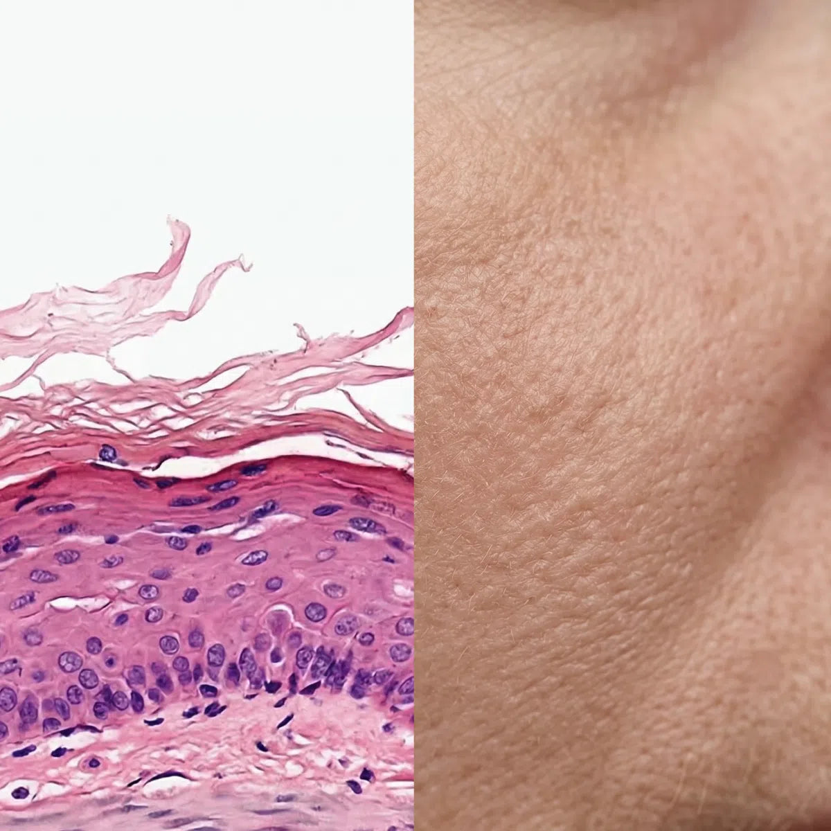 Skin Cell Alignment Cell-to-Surface – The Skin Diary