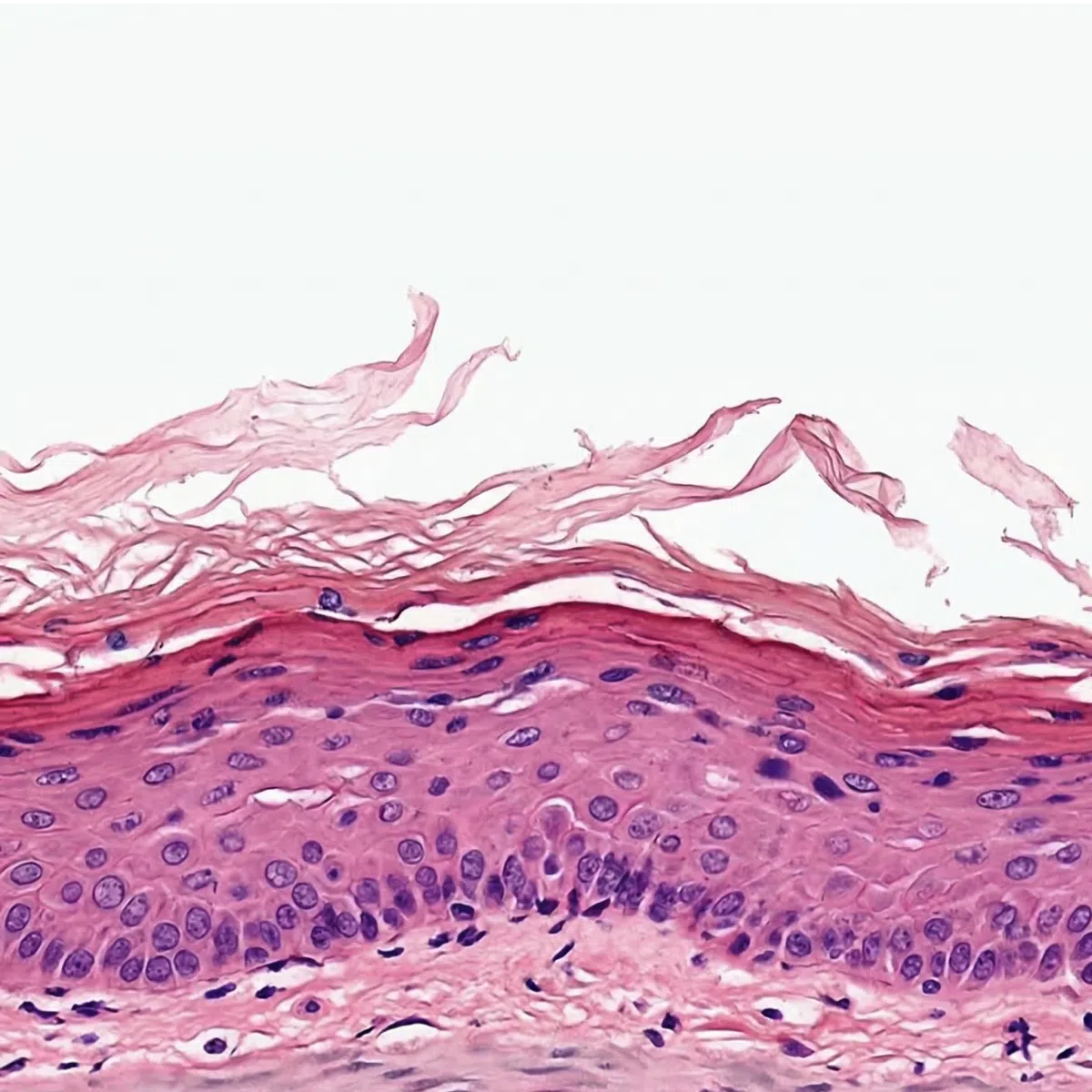 Simulation of photoaged skin histology using H&E staining, showing compromised and roughened skin barrier