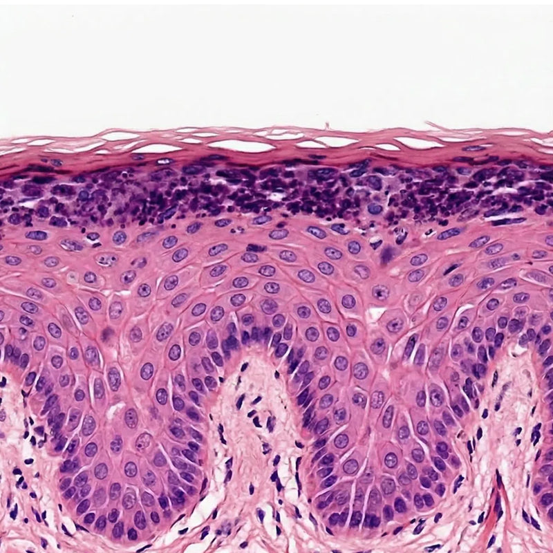 Simulation of healthy skin histology using H&E staining, showing intact skin barrier