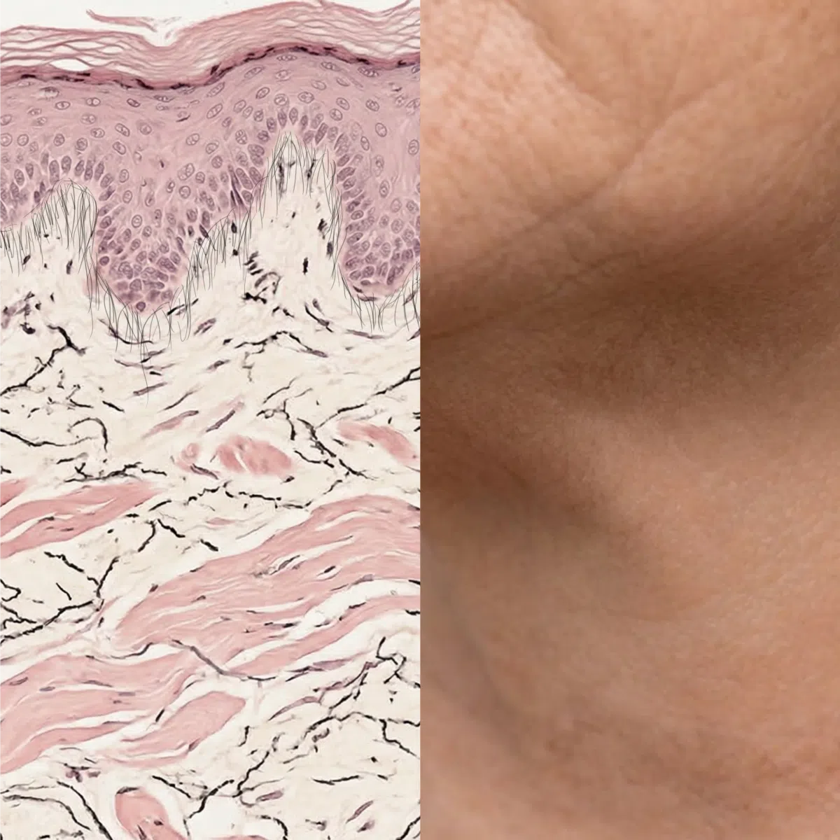 Skin Cell Alignment Cell-to-Surface – The Skin Diary