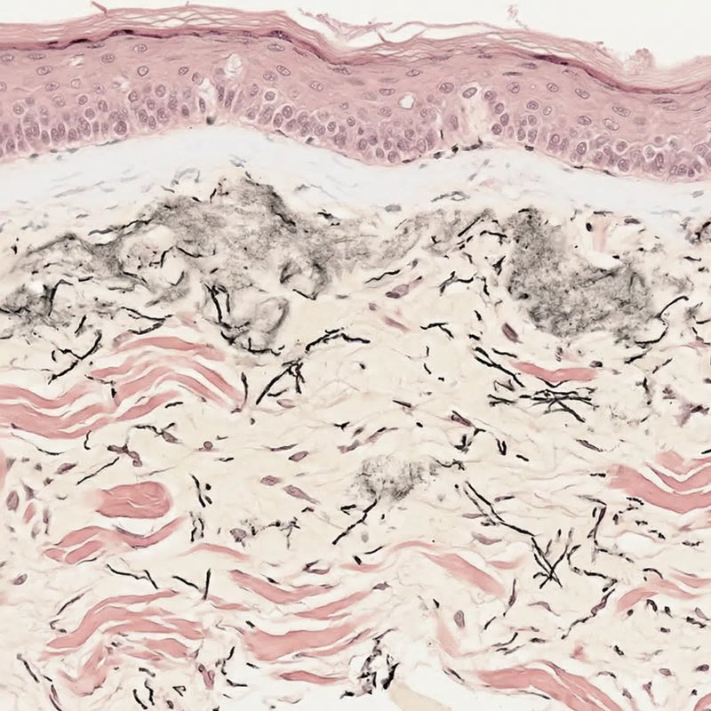 B: Photoaged, Wrinkled Female Facial Skin (H&E)