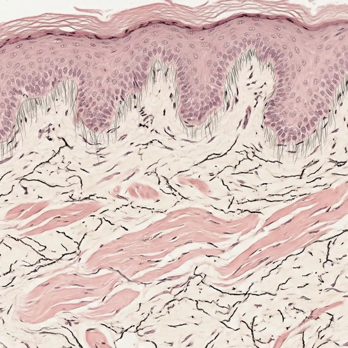 Verhoeff-Van Gieson staining showing organised elastic fibres in healthy skin