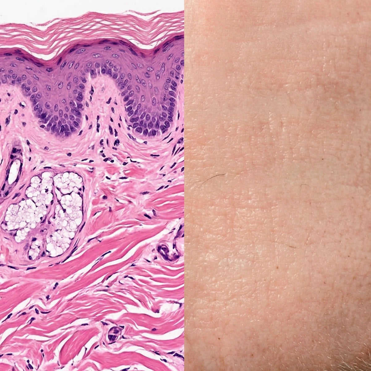Skin Cell Alignment Cell-to-Surface – The Skin Diary