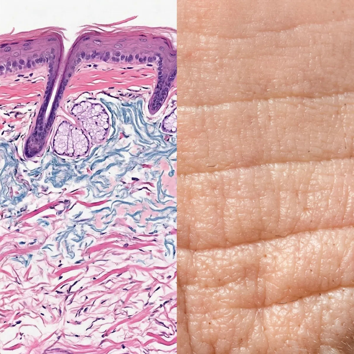Skin Cell Alignment Cell-to-Surface – The Skin Diary